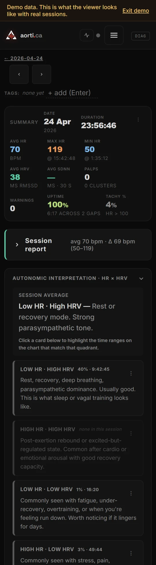 Day view before, step 2, phone: the full-day timeline page, with the numbers, the session report and interpretation cards filling the screen before the chart