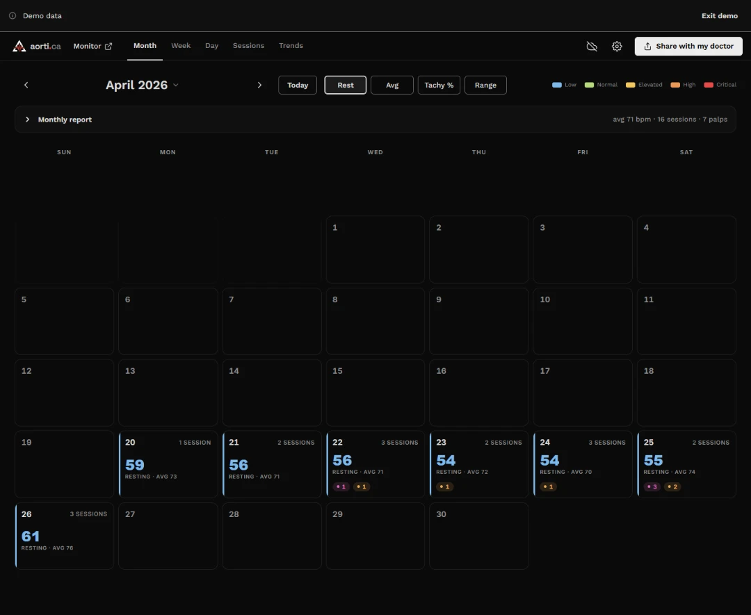 Month now, laptop: April calendar with the arrows at the row ends and full-size lens buttons