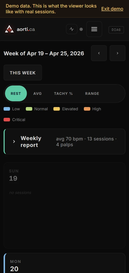 Week before, phone: the week title, arrows and day cards